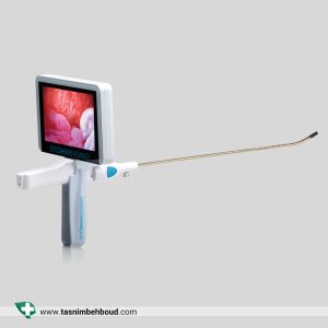 هیستروسکوپی مطبی اندوسی ادونس